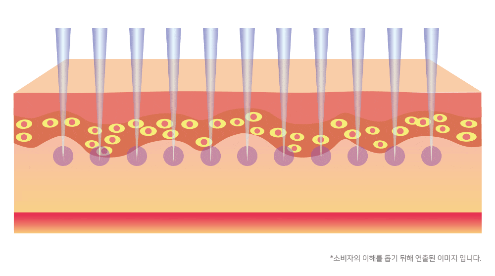 보탬큐브 프로페셔널 피부미용기기 이미지 4